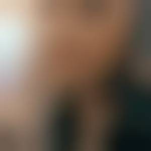 anet03