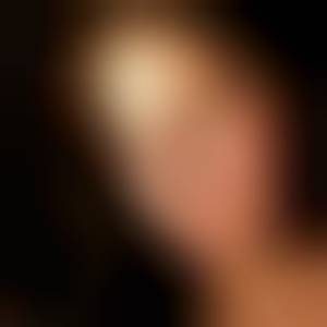 els